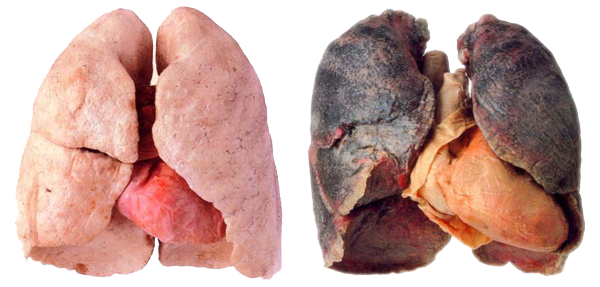 long rokerslong